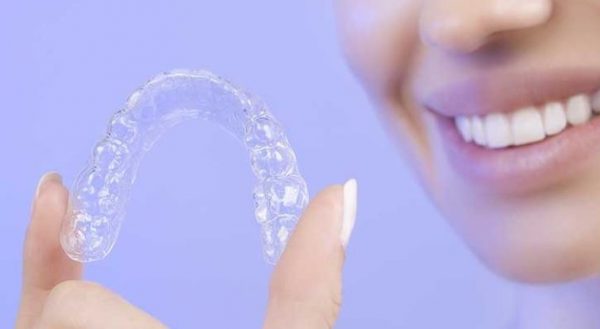 Custom whitening trays – Even28: Dentist Search Engine