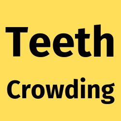 teeth-crowding