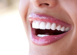 best-dentist-delivered-teeth-straightening-system