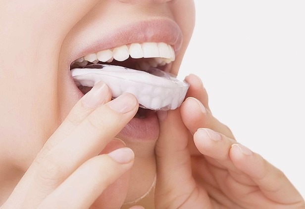 correctly-wearing-teeth-whitening-trays