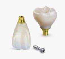 Dental-Implant-Abutment-Crown