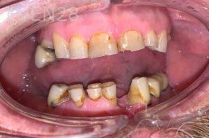 Chrisopher-Andonian-Dental-Crowns-before-1