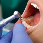 Exam-Xrays-Dental-Cleaning