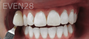 Guitta-Harb-Teeth-Whitenin-After-1