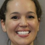 Mark-Nguyen-Invisalign-clear-aligners-after-4