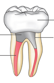 Root-Canal-Post-crown