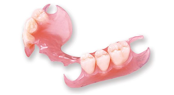 flexible-partial-denture