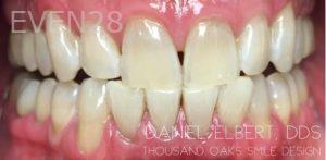 Daniel-Elbert-Teeth-Whitening-after-2